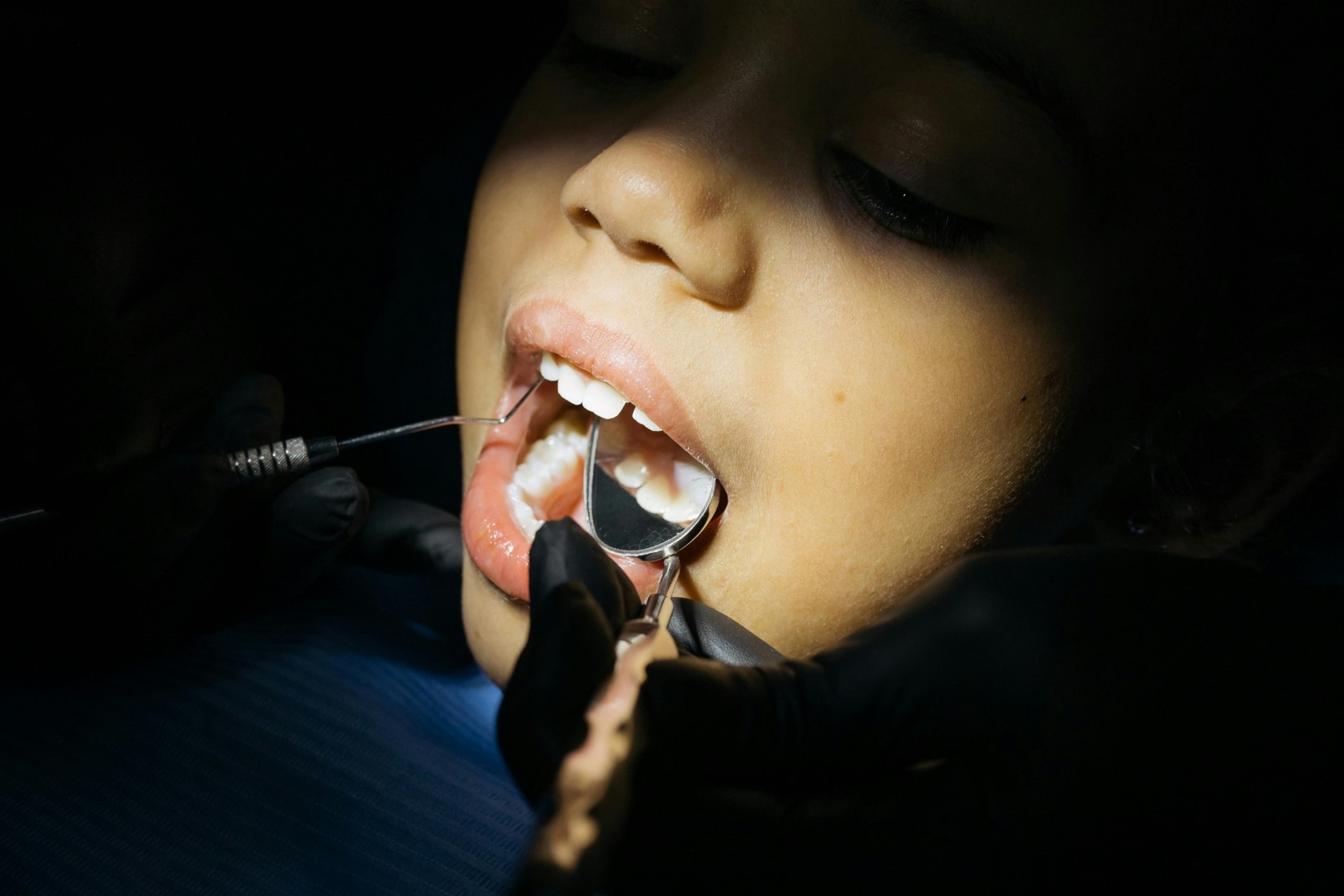 children oral health